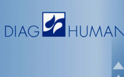 Diag Human chystá exekuci majetku ČR. Česko ještě zkouší, jak kauzu zvrátit