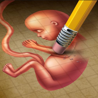 Report SG červen 25, CHYŤTE ZLODĚJE!